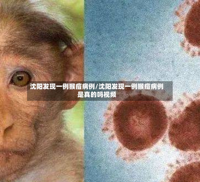 沈阳发现一例猴痘病例/沈阳发现一例猴痘病例是真的吗视频