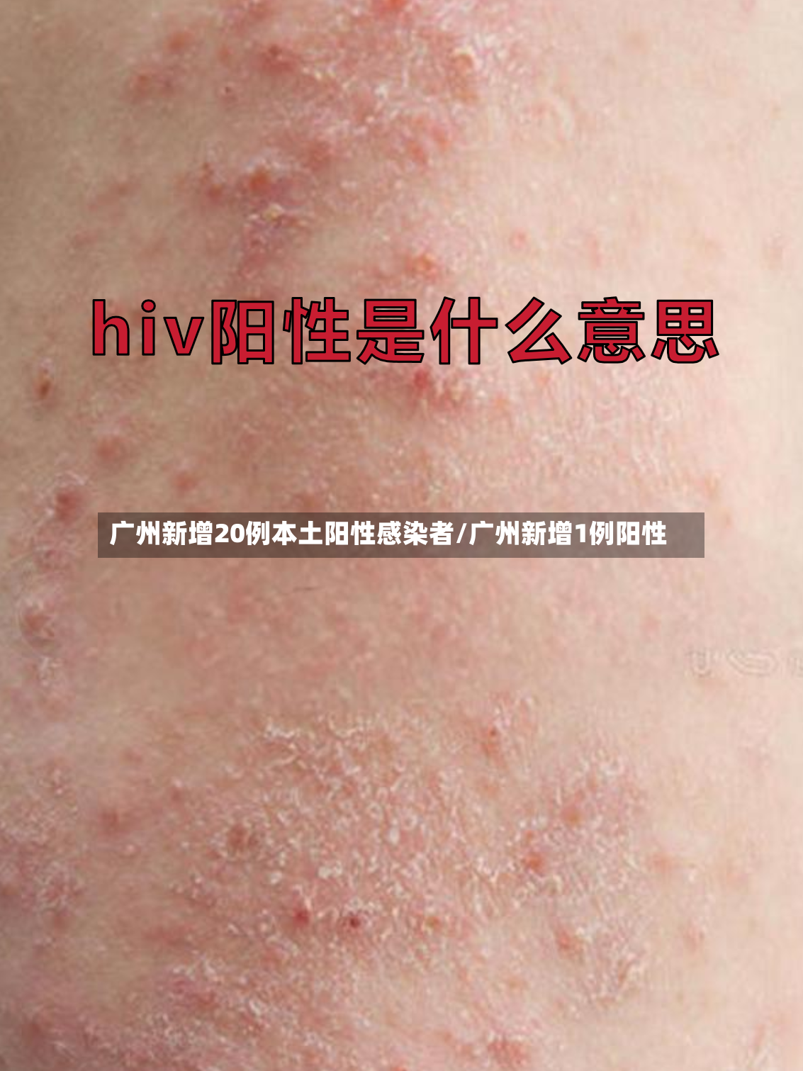 广州新增20例本土阳性感染者/广州新增1例阳性