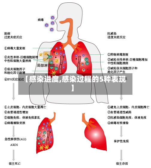 【感染进度,感染过程的5种表现】