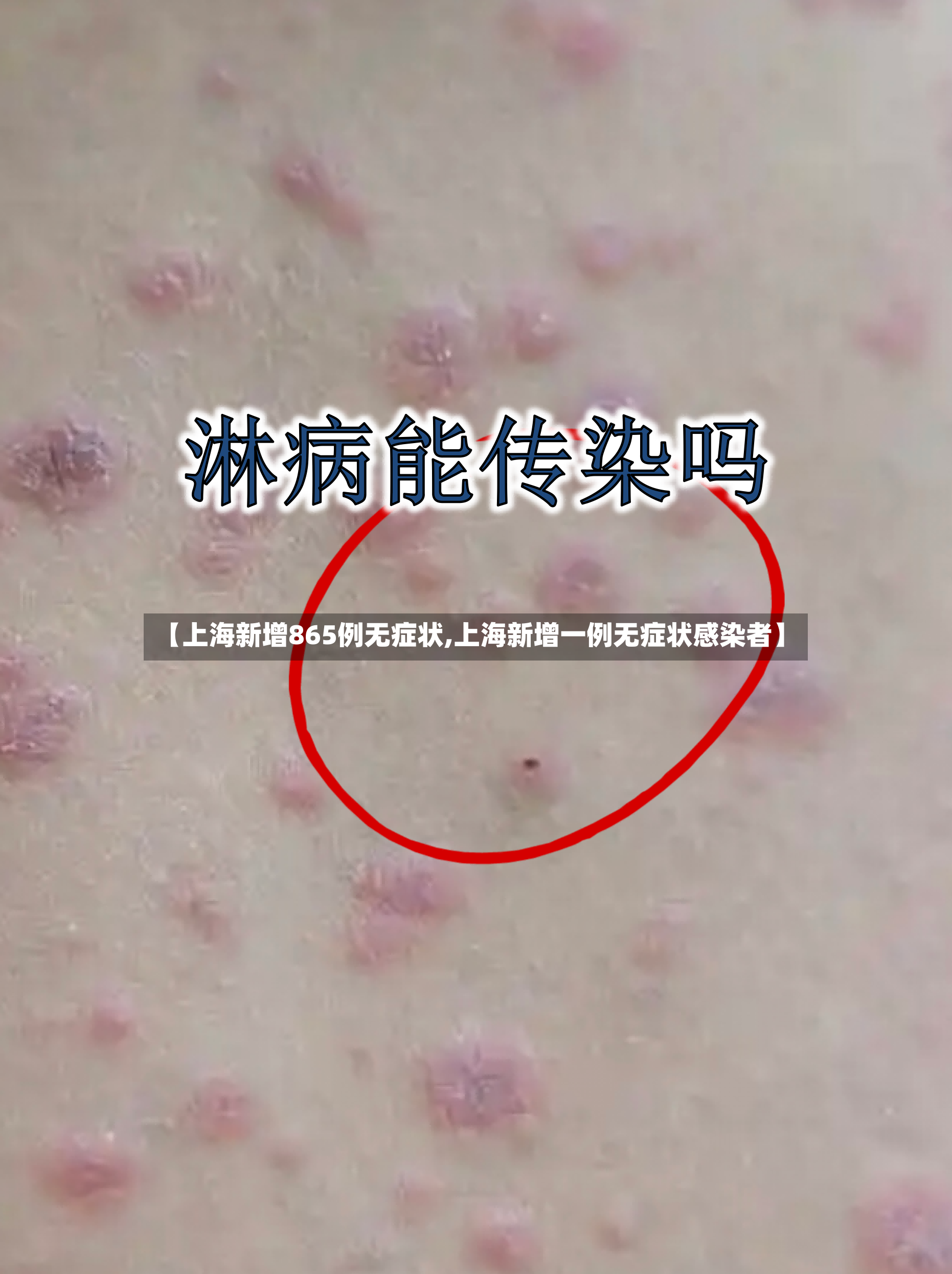 【上海新增865例无症状,上海新增一例无症状感染者】-第3张图片