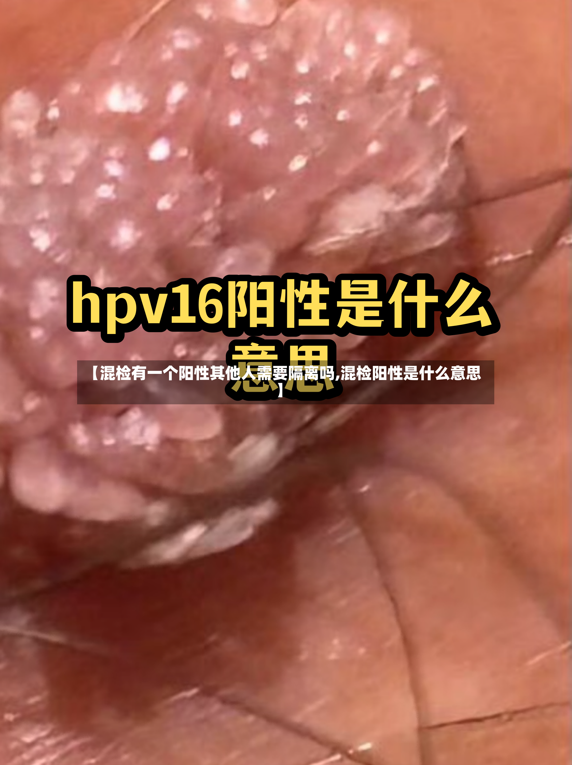 【混检有一个阳性其他人需要隔离吗,混检阳性是什么意思】-第2张图片