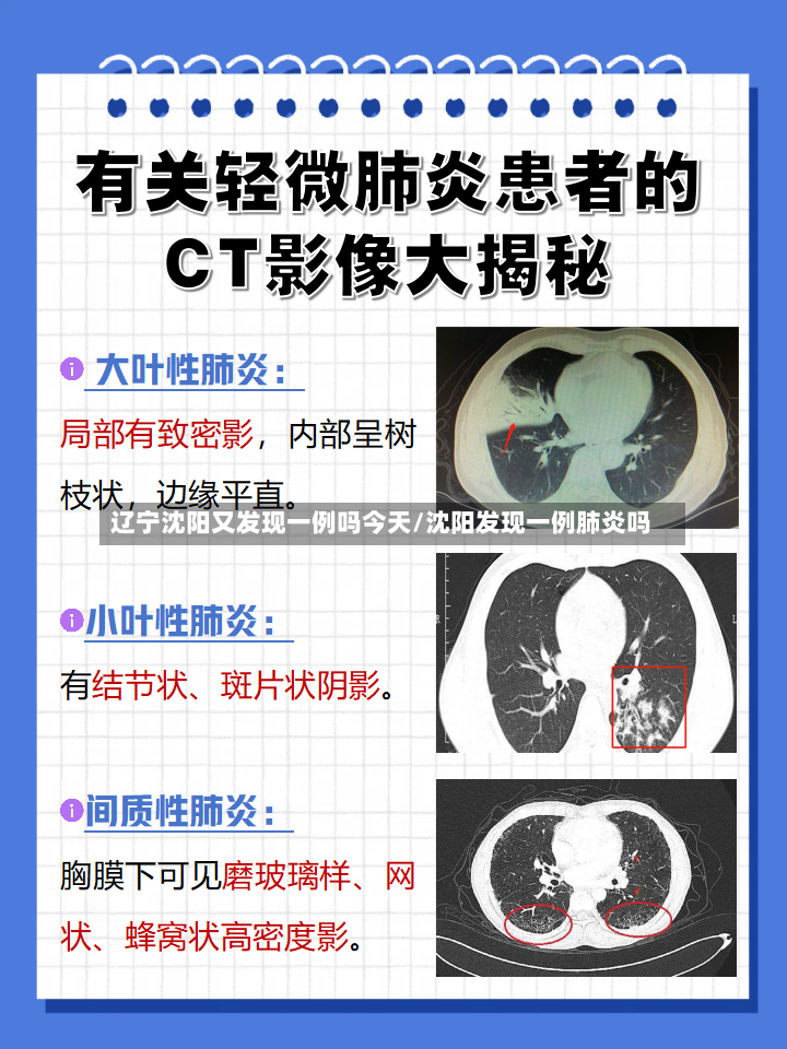 辽宁沈阳又发现一例吗今天/沈阳发现一例肺炎吗-第3张图片