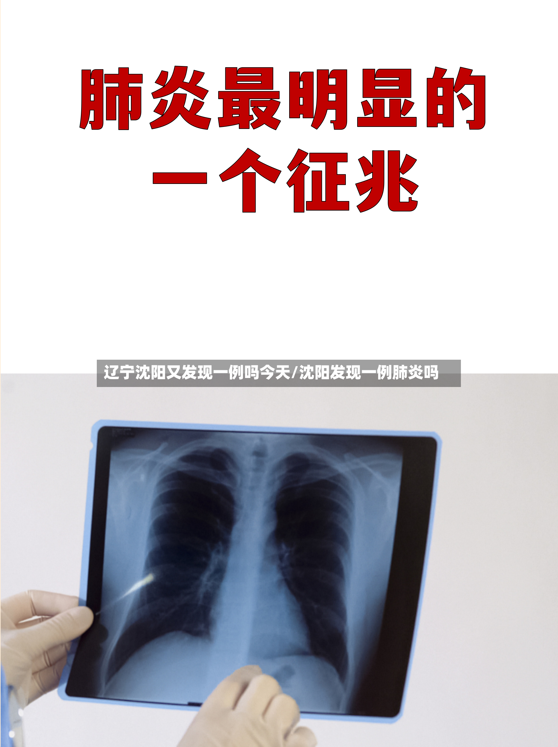 辽宁沈阳又发现一例吗今天/沈阳发现一例肺炎吗