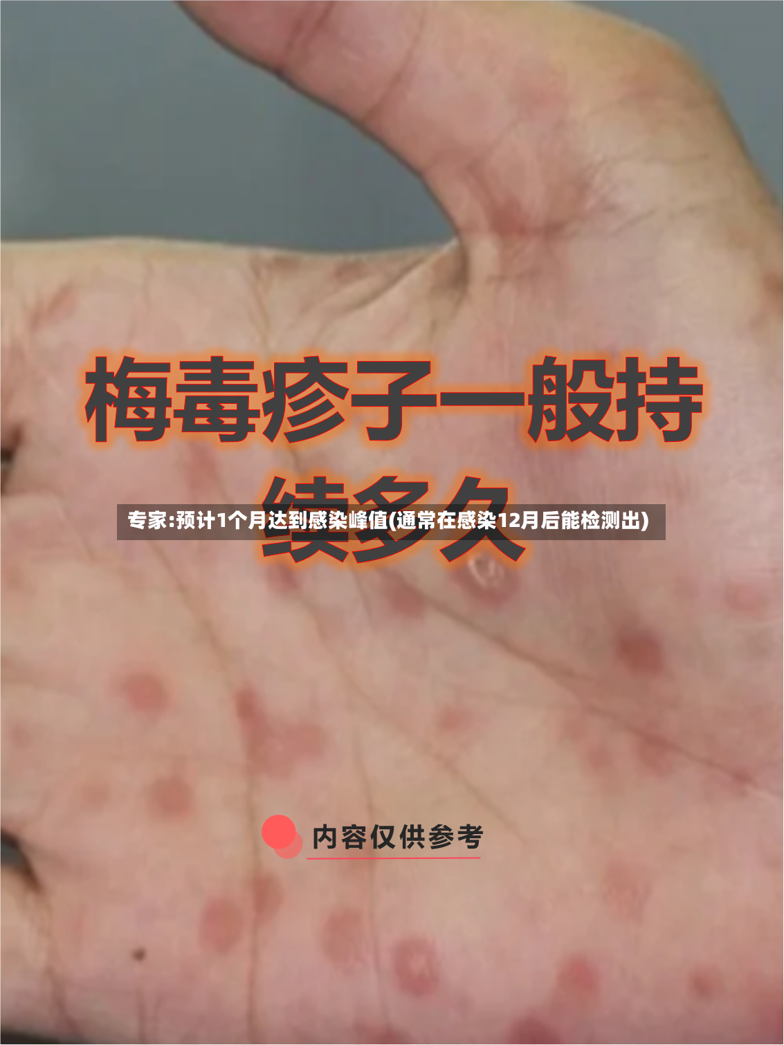 专家:预计1个月达到感染峰值(通常在感染12月后能检测出)