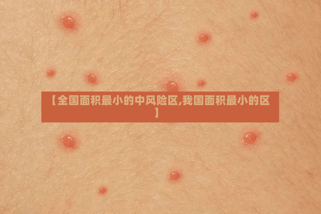 【全国面积最小的中风险区,我国面积最小的区】-第2张图片