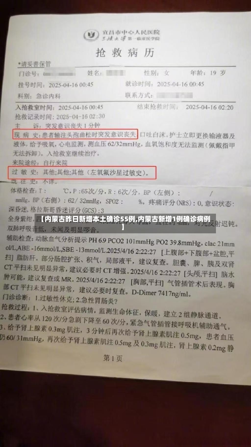 【内蒙古昨日新增本土确诊55例,内蒙古新增1例确诊病例】-第1张图片