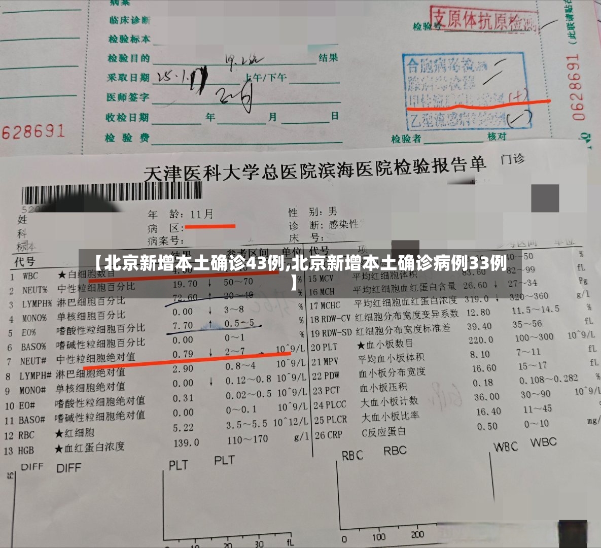 【北京新增本土确诊43例,北京新增本土确诊病例33例】-第2张图片
